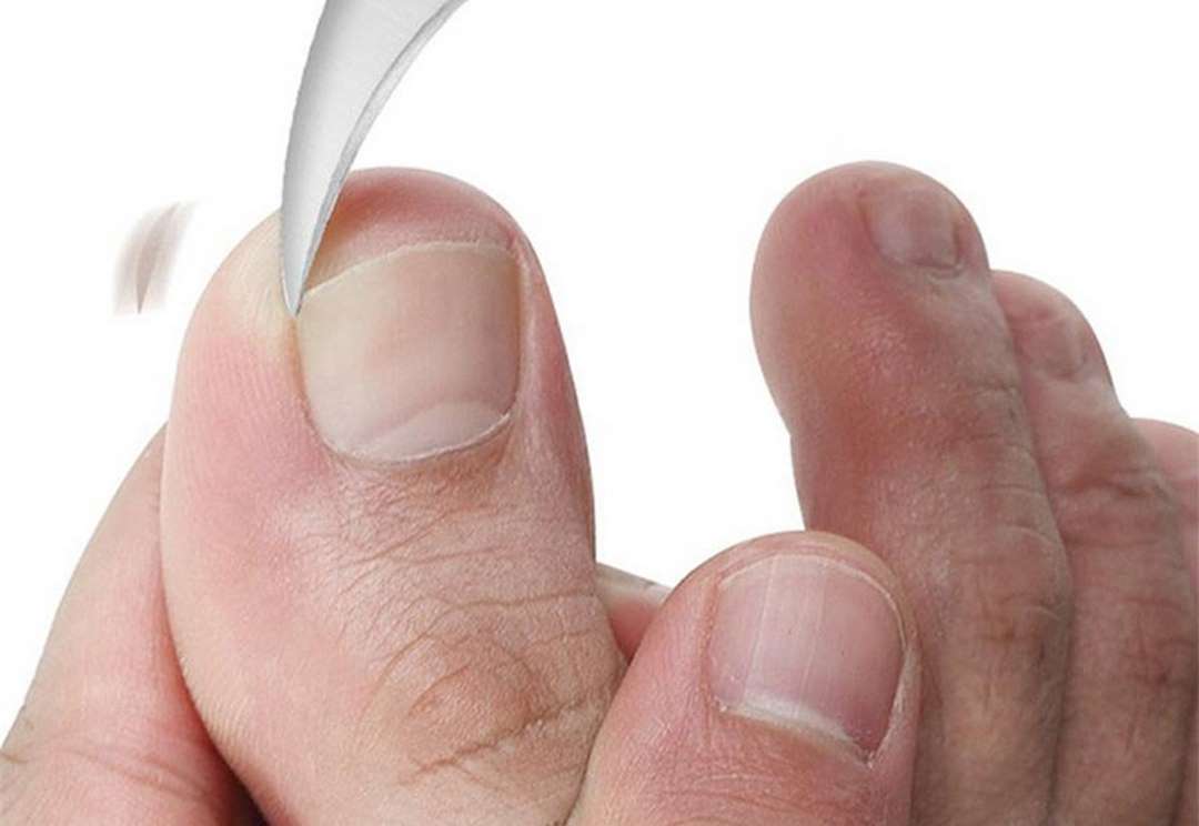 Cắt móng tay, móng chân thường xuyên phòng bệnh