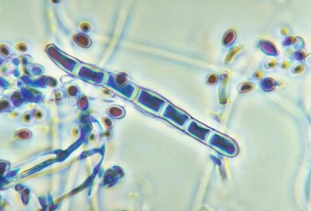 Vi nấm Trichophyton là nguyên nhân gây ra bệnh nấm móng