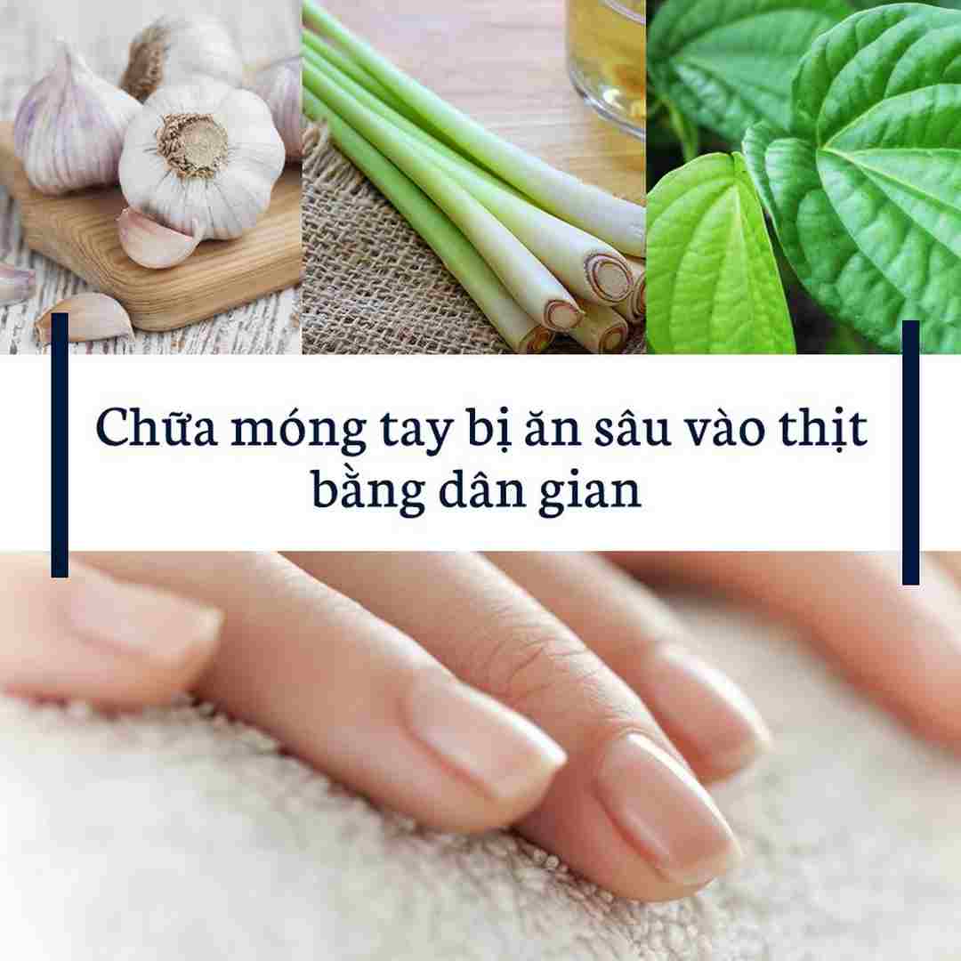 Bật mí cách chữa móng tay bị tụt dần hiệu quả bằng dân gian