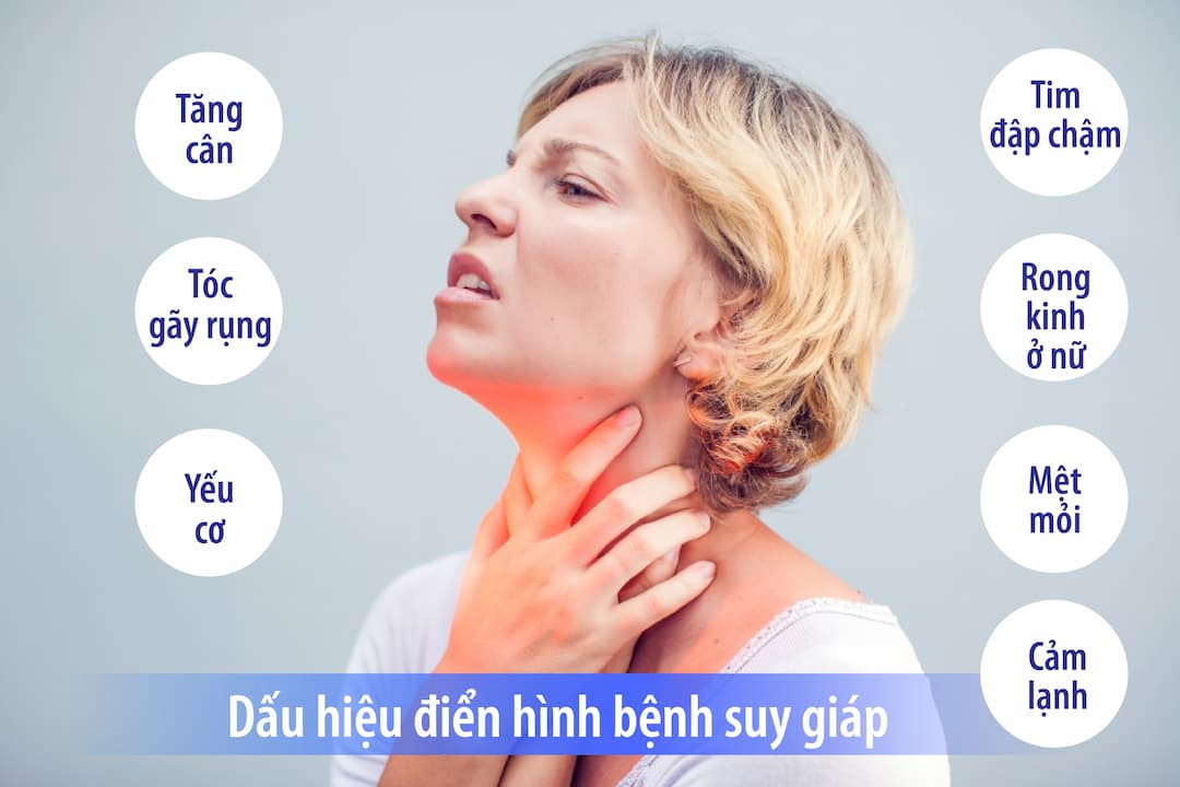 Cách nhận biết người bệnh bị suy tuyến giáp