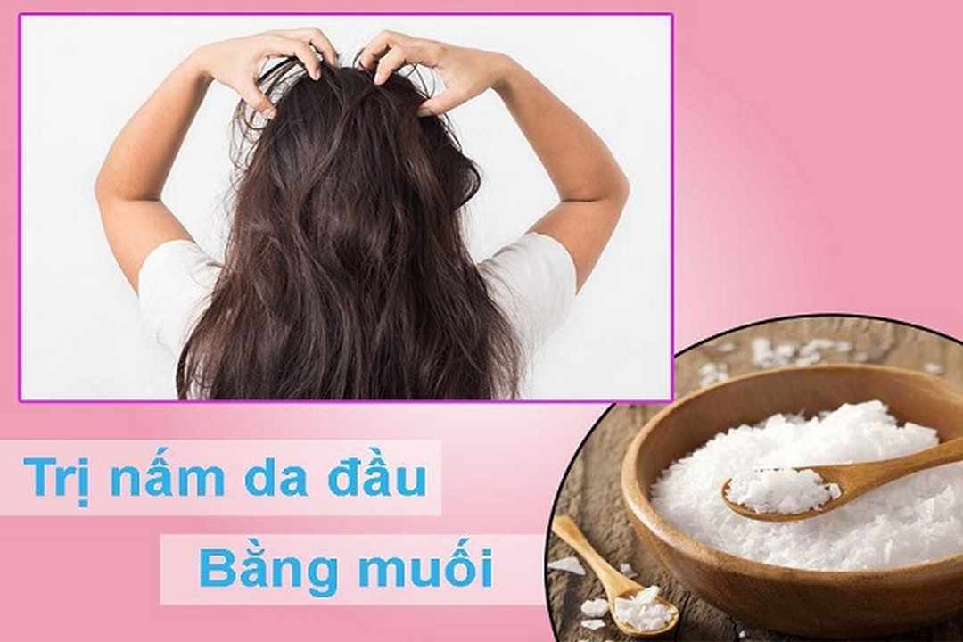 Muối kết hợp với chanh để trị nấm