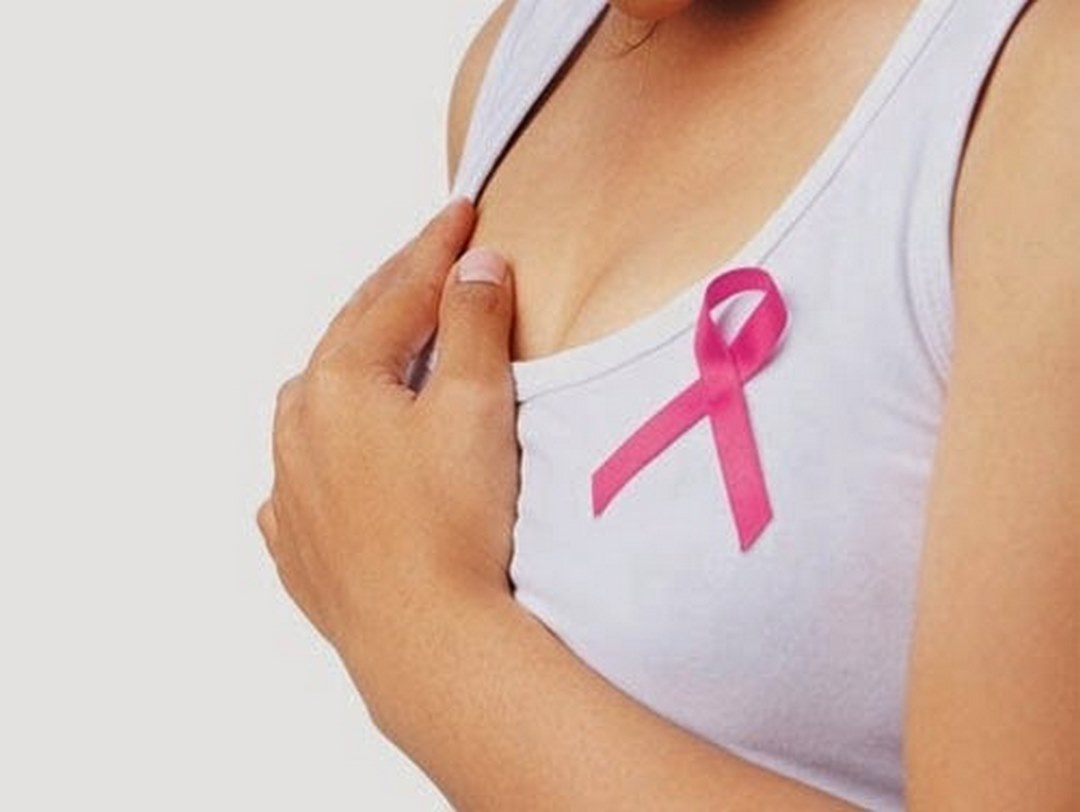 Ung thư vú là bệnh lý ác tính bắt nguồn tại vú