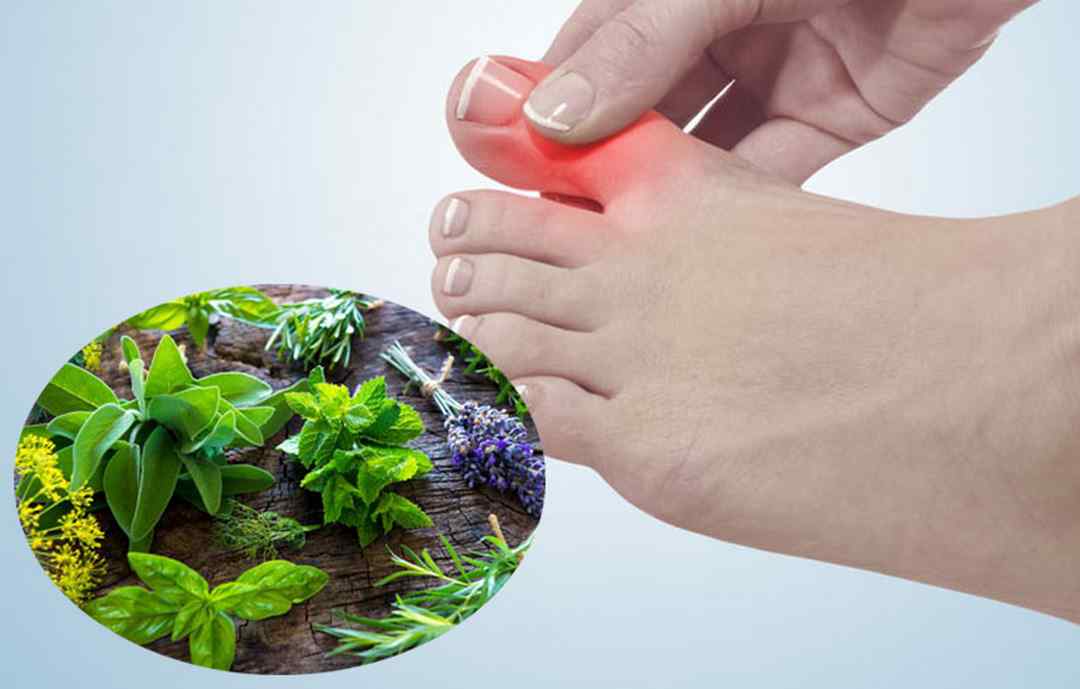 Một số lưu ý khi sử dụng thuốc trị gout