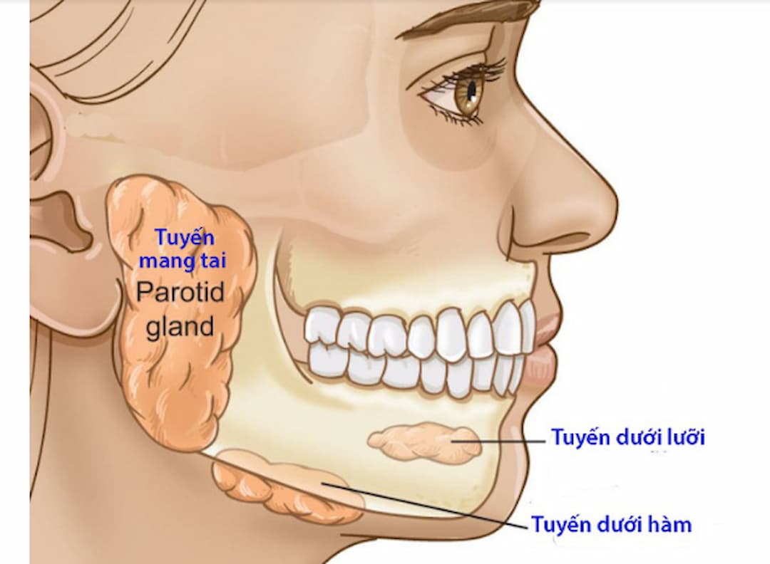 Viêm tuyến nước bọt biểu hiện như thế nào?