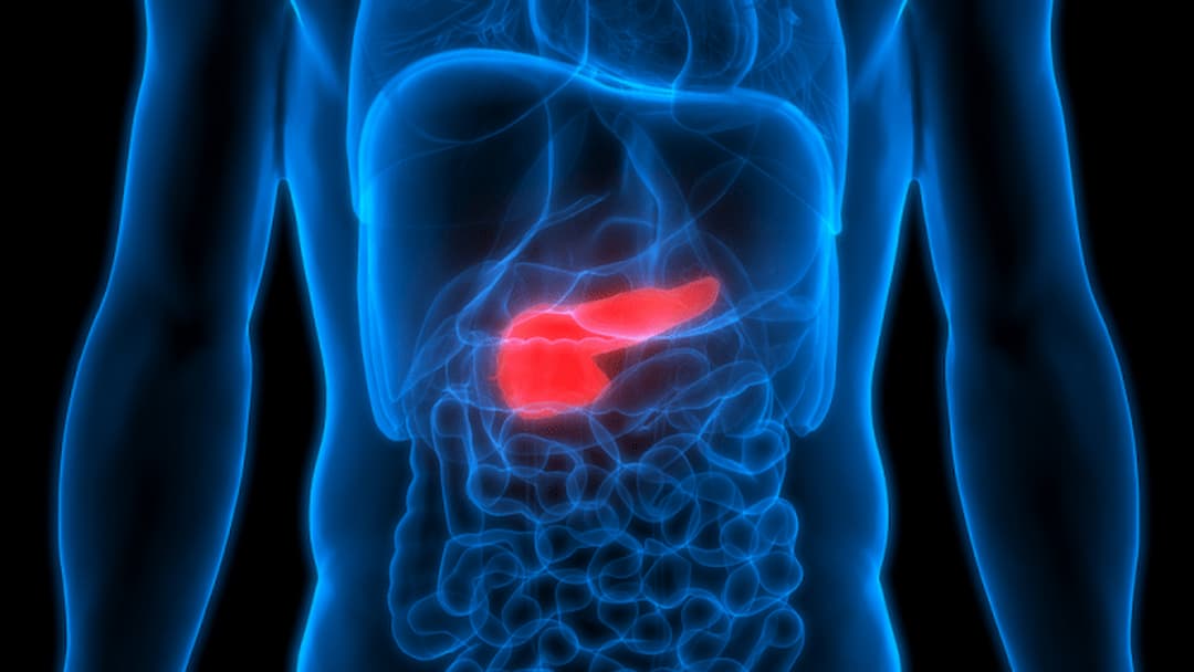 Đau bụng cũng có thể là dấu hiệu ung thư tụy